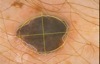 Asymétrie